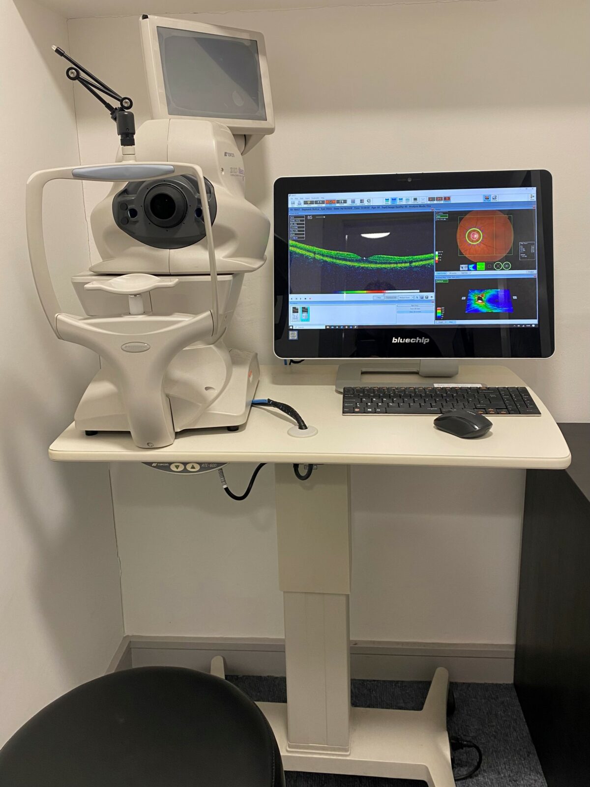 OCT 3D Retinal Scanning Technology Vision 2 Opticians